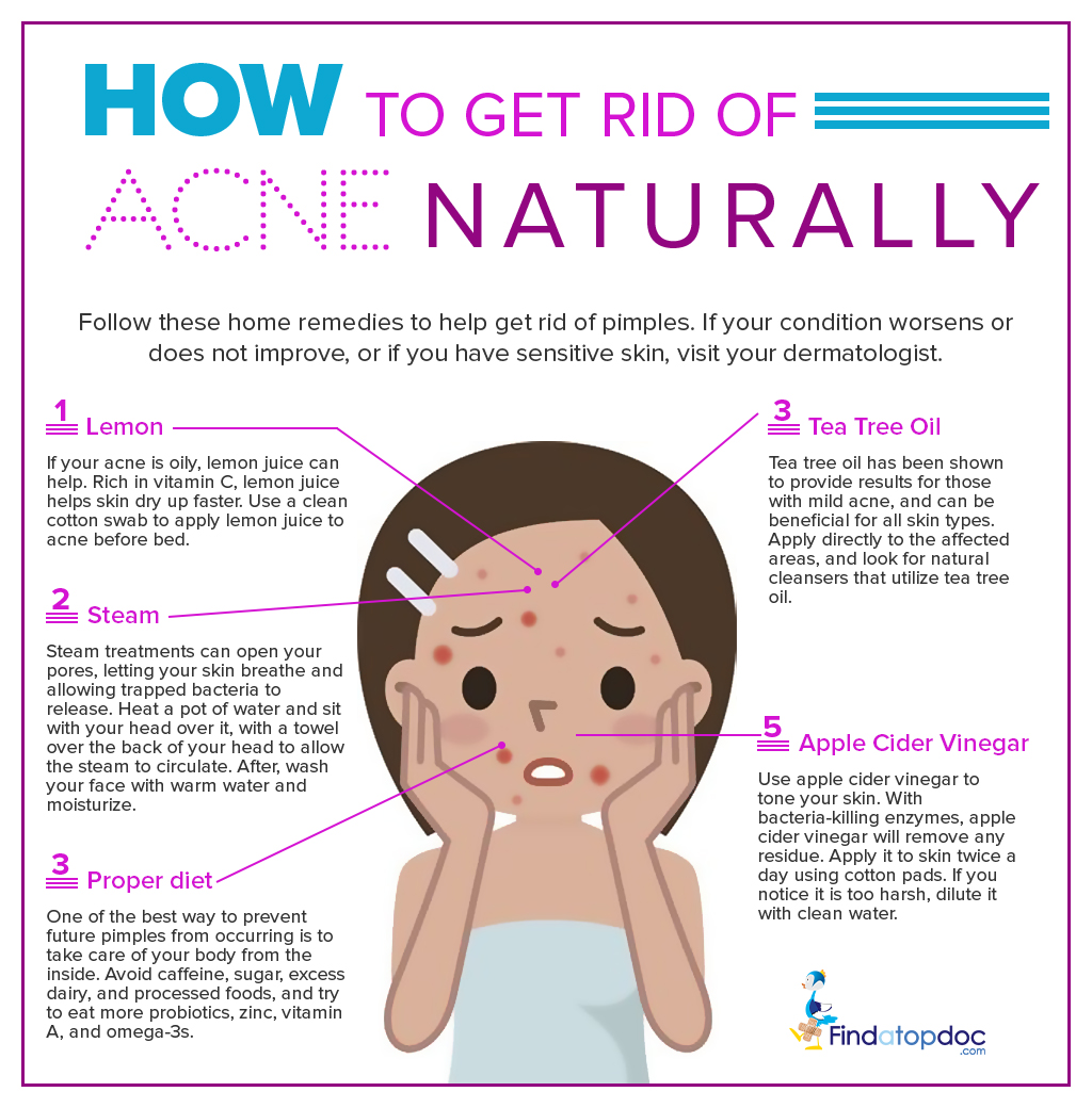 How to Get Rid of Acne Naturally – FindaTopDoc Blog